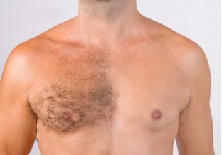 epilation torse homme lannemezan
